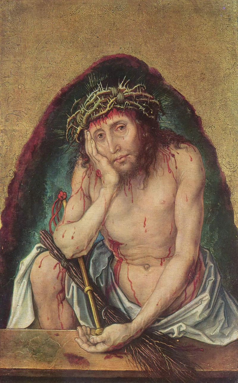 Manden med smerter - Albrecht Dürer