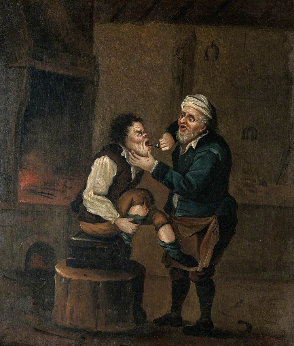 Un maréchal-ferrant extrait une dent de la bouche d'un homme - David Teniers le Jeune